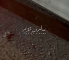 بالفيديو حادث سير مروع بالقرب من ساحة عدن بين ثلاث عجلات، أسفر عن إصابة عدد من ا…