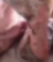 مشاهد قد لا تناسب البعضجسد الزوجة المعنفة باسلوب الحرق يتآكل بسبب الديدان، متروك…