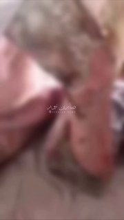 مشاهد قد لا تناسب البعضجسد الزوجة المعنفة باسلوب الحرق يتآكل بسبب الديدان، متروك…