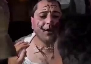 سوريا تحت حكم عصابات الجولاني الارهابية خطف وتعذيب المطرب عمر خيري على يد العصاب…