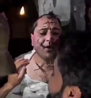 سوريا تحت حكم عصابات الجولاني الارهابية خطف وتعذيب المطرب عمر خيري على يد العصاب…