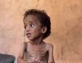 يموت الأطفال جوعًا في غزة، وأجسادهم الصغيرة التي كانت تنبض بالحياة تحوّلت إلى هي…